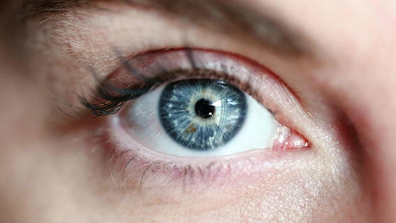 ¿Cuál es el color de ojos más común en el mundo?